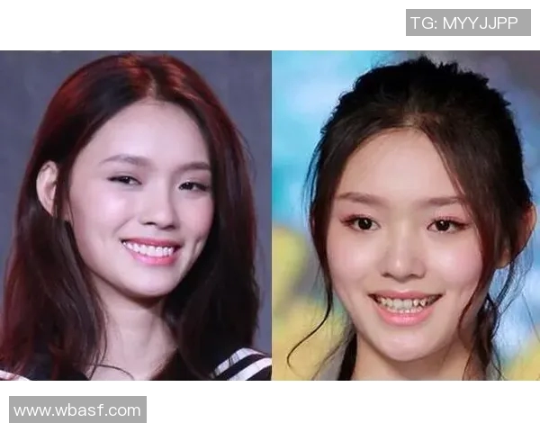 整容改变命运的足球球星揭秘他们的颜值背后故事